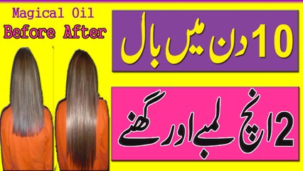 Balon Ko 10 din mein 2 Inch Lamba Krne Ka Oil