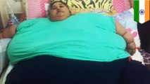Wanita terbesar di dunia akan operasi ekstrim untuk menurunkan berat badan - Tomonews