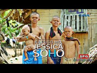 Kapuso Mo, Jessica Soho: The rare case of poreless skin in four siblings
