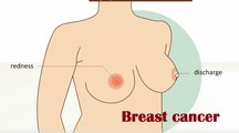 Breast cancer # Symptoms and treatment