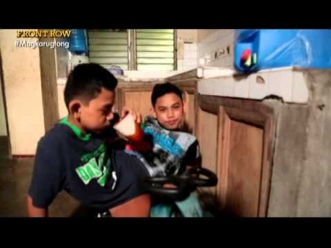 Life through the faces of conjoined twins | Front Row