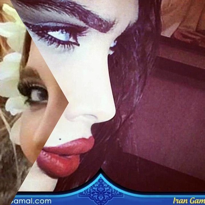 عمليات تجميل الانف في ايران (9)