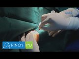 Pinoy MD: Benepisyo ng angioplasty, tinalakay sa 'Pinoy MD'