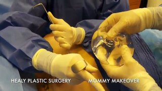 Mommy Makeover Honolulu Hawaii Healy Plastic Surgery