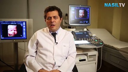 [640x360] Doğumun başladığı nasıl anlaşılır videolu anlatım - Mynet Kadın Tv