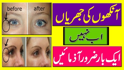 Eye Wrinkle Removal Tips In Urdu | Anakhon Ki Jhuriyan Khatam Kare Ka Trika
