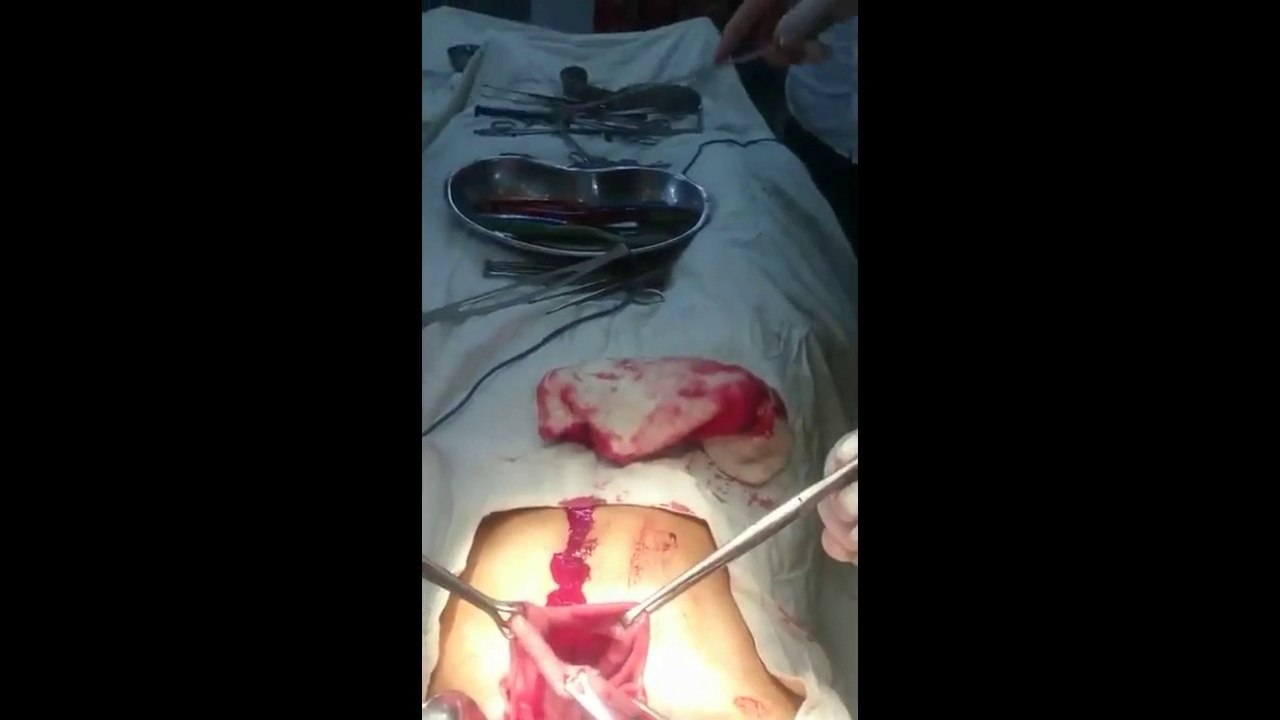 25 brosses à dents dans le ventre