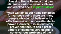 68. Amazing Home Remedy that can eliminate varicose veins, calluses and cracked heels in just 10 days!