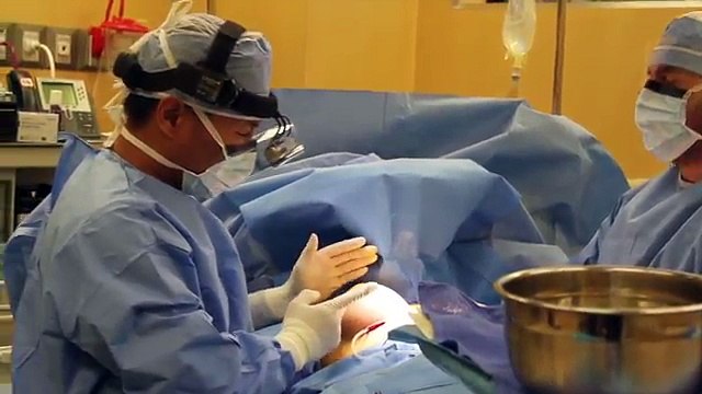 Breast Augmentation Procedure Breast Implants Sugar Land Plastic Surgery