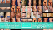 Laser Lipo Chicago South Loop | Smartlipo Downtown Chicago Illinois