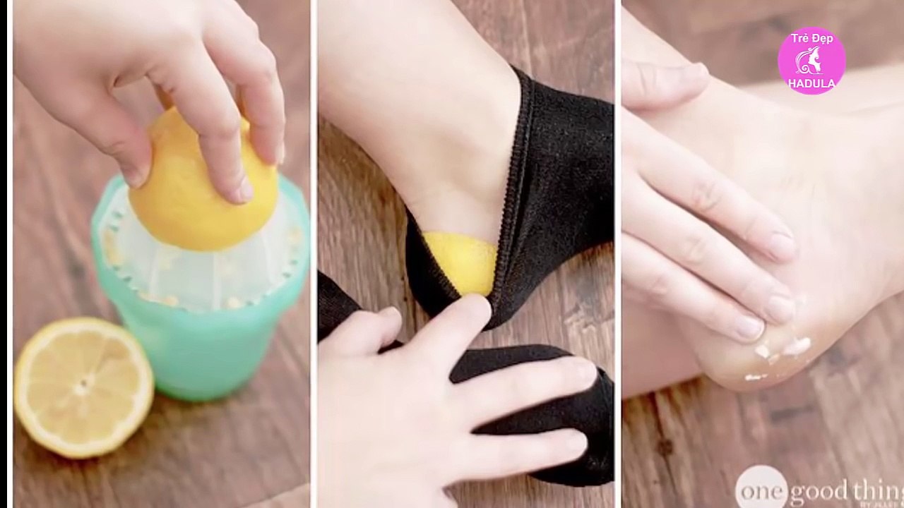 Đến Kem Trị Nẻ Cũng Phải “Chào Thua”