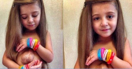 7 years old girl born with heart outside her chest is hoping for operation
