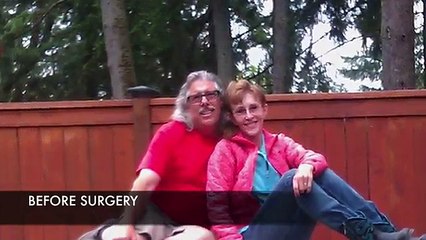 Having a Facelift _ Eyelid Surgery in Seattle Washington with Dr William Portuese