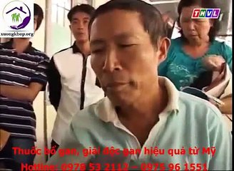 Bệnh viêm gan B, nguyên nhân và cách điều trị
