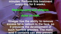 76. Apple cider vinegar in your face helps eliminate toxins, eczema and age spots