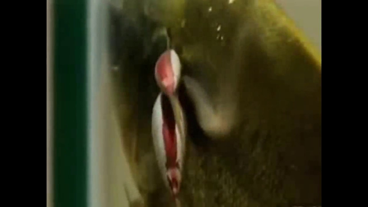 衝撃！！カンディルが膀胱に入って摘出される動画！！