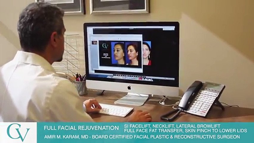 Facelift Surgery - Facial Rejuvenation - Fat Transfer - Amir Karam MD