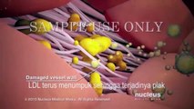 LDL dan HDL - Kolesterol Jahat dan Kolesterol Baik Subtitle Indonesia
