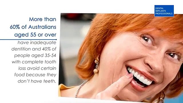 Benefits of Dental Implants in Sydney| Watch Now