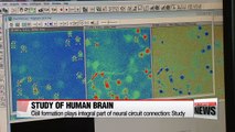 Researchers develop MRI software, cell reconstruction to study human brain