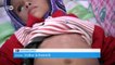 Jemen: Hungerkrise bedroht Millionen Kinder | DW Nachrichten
