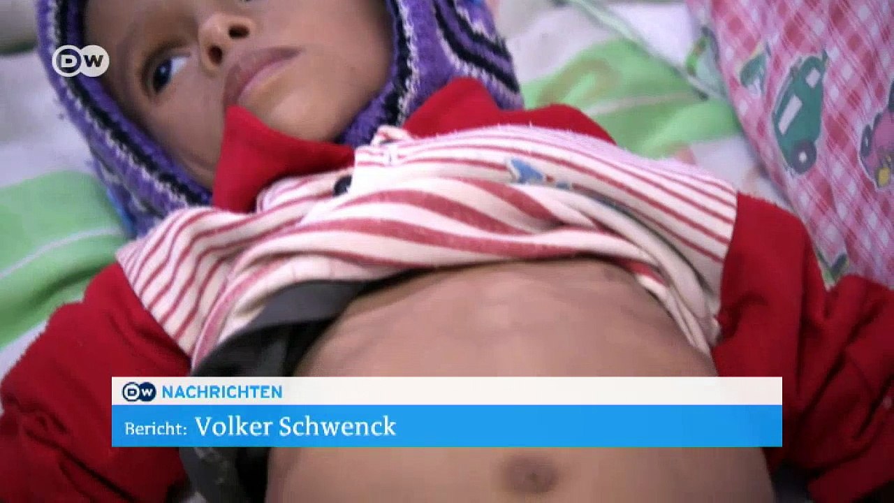 Jemen: Hungerkrise bedroht Millionen Kinder | DW Nachrichten
