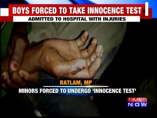 Five Minors Forced To Take Boiling Oil Test To Prove Innocence