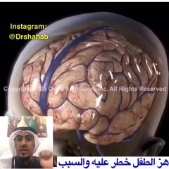 إحذروا من هز الطفل الرضيع