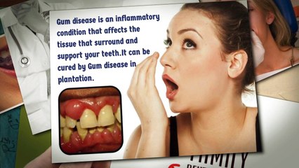 Invisalign Clear Braces in Plantation, FL