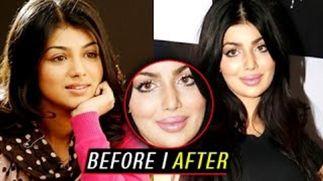 Ayesha Takia's SHOCKING LIP SURGERY GONE WRONG! | Plastic Surgery
