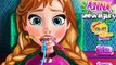 ღ Princess Anna Tooth Injury - Disney Frozen Dentist Game For Little Girls ღ