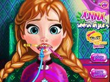 ღ Princess Anna Tooth Injury - Disney Frozen Dentist Game For Little Girls ღ