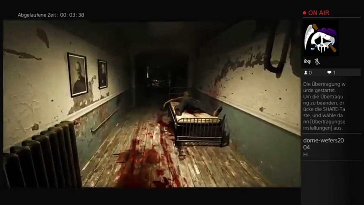 PS4-Live-Übertragung von OP-_-Aimer_Lz