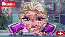 Elsa Skin Doctor: Disney princess Frozen Elsa - Best Baby Games For Kids