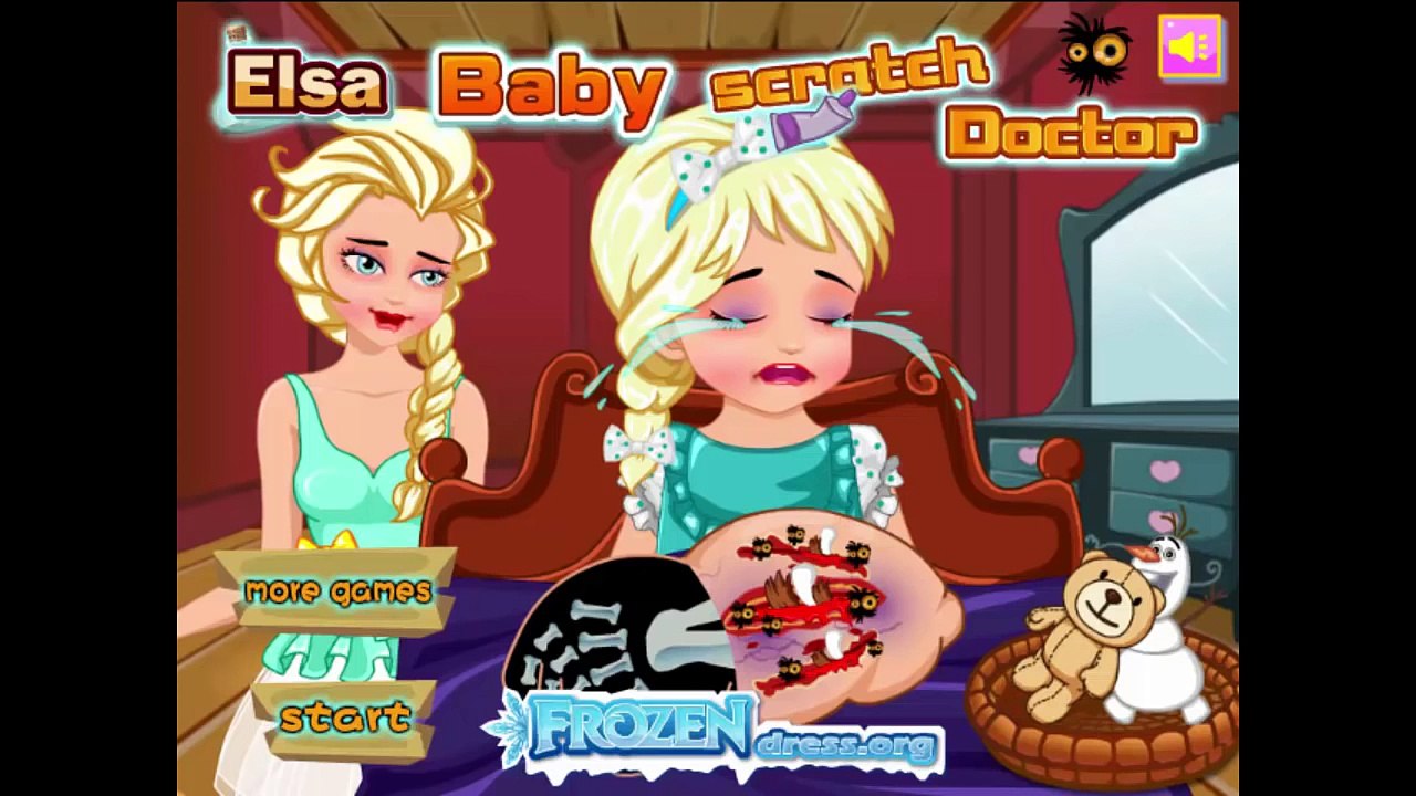 Elsa Baby Scratch Doctor - Baby Surgery Game - Doctor Game For Kids