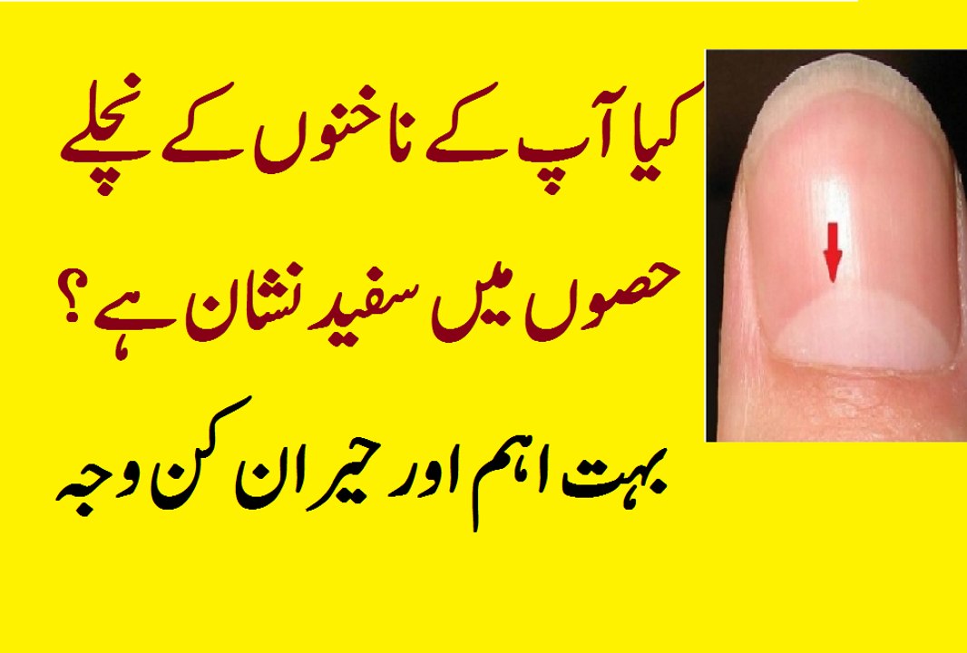 Nakhun nails par sarsun mostard ka tail lagain aor 06 khatarnaak bimariyoun se bachain.