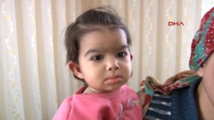 Adana Minik Bebeğin Cildi Sürekli Kanıyor