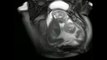 Twin Babies Caught On MRI Scan Fighting In Their Mother’s Womb! Amazing!