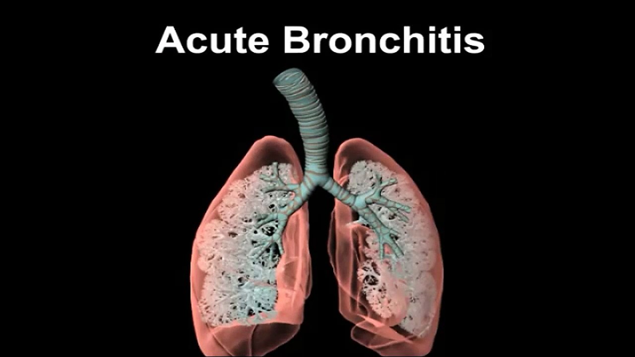 Acute Bronchitis