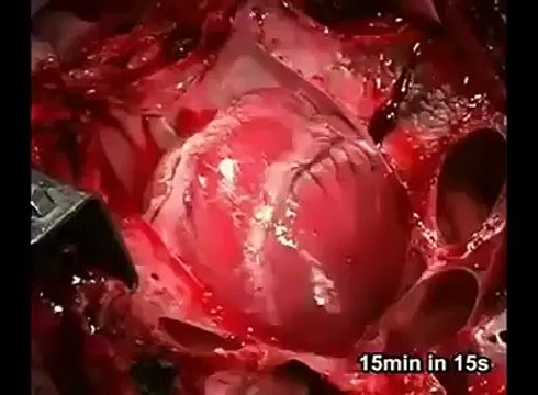 Shikoni si ndalon zemra kur vdes njeriu