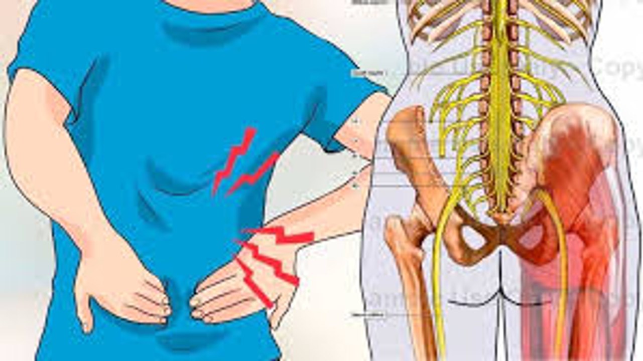 100.  2 ways to unlock the sciatic nerve in 2 minutes, loosen it at once and stop the pain