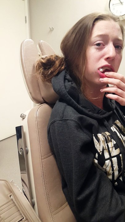 Wisdom Teeth Troubles