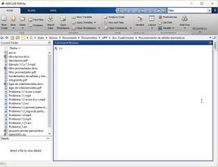 Guía Completa para Implementar Filtro Notch en MATLAB 🎯