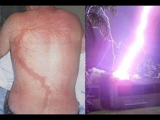 Những khả năng siêu phàm của người “sét đánh” không ch.ế.t!