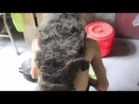 Chuyện lạ Việt Nam- Người đàn ông hơn 10 năm khổ sở vì mái tóc 'quái dị'.