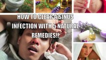 How To Clear A Sinus Infection With 5 Natural Remedies (Cure SINUS COMPLETELY)