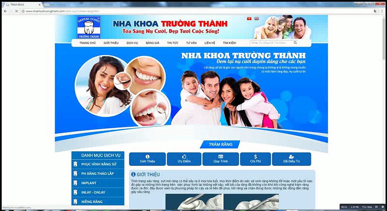 Trám Răng - Nha Khoa Trường Thành