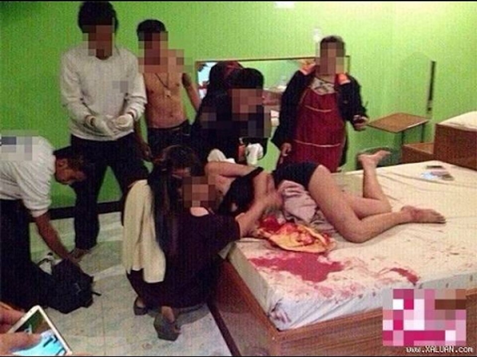 Hoảng hồn với hậu quả rùng mình của cô gái chơi "tình thú" quá đà cùng người yêu