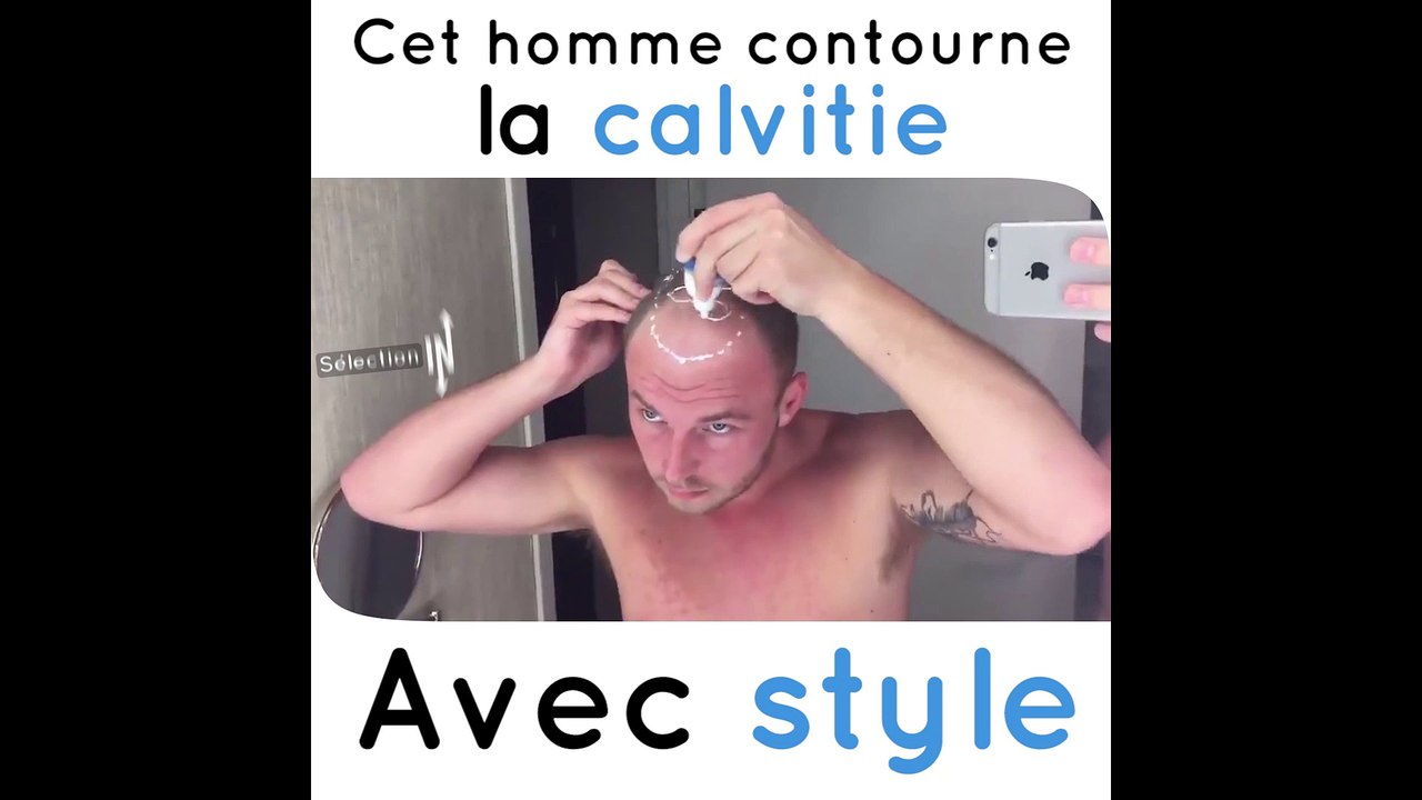 Quiff & Co, une solution invisible à la calvitie