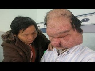 Chuyện lạ có thật - Những căn bệnh kỳ lạ nhất thế giới